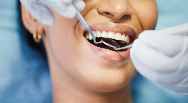 Best Teeth Whitening  in Marshall, MN