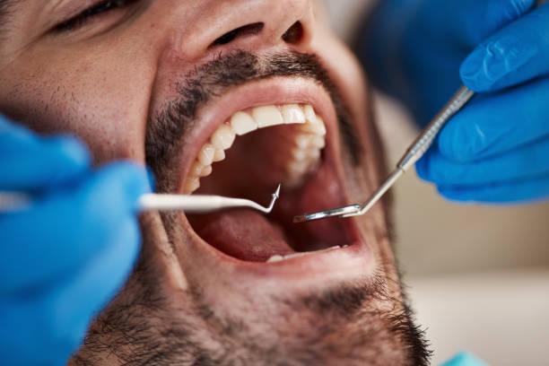 Best Knocked-Out Tooth Emergency  in Marshall, MN
