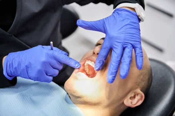Best Tooth Infection Emergency Dentist  in Marshall, MN